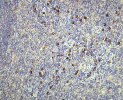 Immunohistochemistry-Paraffin: Kappa Light Chain Antibody (A21-Y) [NBP1-30139] - Expression of the Kappa Light Chain immunoglobulin in the plasma cells of the palatine tonsil. Formalin fixed, paraffin embedded human tissues (4 um sections) stained with anti - Human Kappa light chain (DB 037) monospecific clonal antibody.