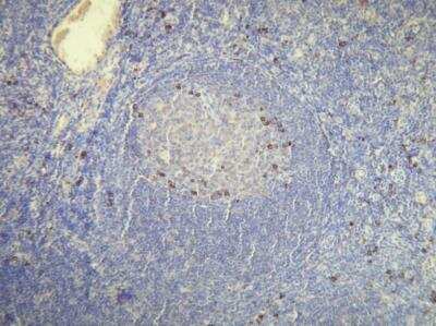 Immunohistochemistry-Paraffin: Kappa Light Chain Antibody (H16-E) [NBP1-30140] - Human tissue (4 um section) stained with anti - Human Kappa light chain (DB 038) monospecific clonal antibody.