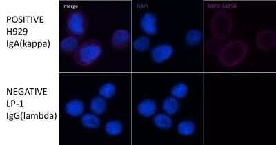 Immunocytochemistry/Immunofluorescence: Kappa Light Chain Antibody (HP6053 + L1C1) - Azide and BSA Free [NBP2-34640] - LP-1 (multiple myeloma) and H929 (multiple myeloma). Image from verified customer review.