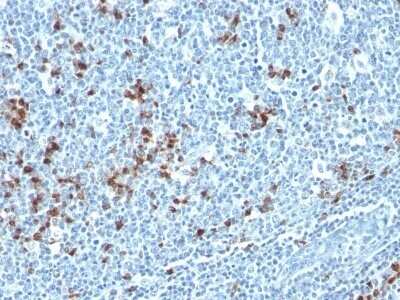 Immunohistochemistry-Paraffin: Kappa Light Chain Antibody (HP6053 + L1C1) - Azide and BSA Free [NBP2-34640] - Formalin-fixed, paraffin-embedded human Tonsil stained with Kappa Light Chain Antibody (HP6053 + L1C1).