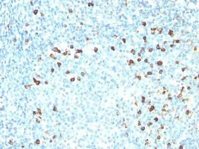 Immunohistochemistry-Paraffin: Kappa Light Chain Antibody (KLC264) - IHC-Prediluted [NBP2-45081] - Formalin-fixed, paraffin-embedded human tonsil stained with Kappa Light Chain MAb (KLC264). Note cell membrane & cytoplasmic staining.