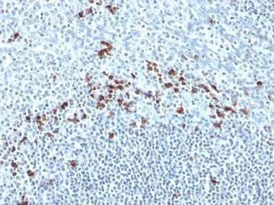 Immunohistochemistry-Paraffin: Kappa Light Chain Antibody (Kap-56) [NBP2-45087] - Human Tonsil stained with Kappa Light Chain Monoclonal Antibody (Kap-56).