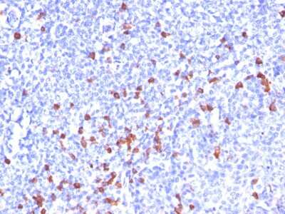 Immunohistochemistry-Paraffin: Kappa Light Chain Antibody (SPM508) [NBP2-34366] - Formalin-paraffin human tonsil stained with Kappa Light Chain MAb (SPM508). Note cell membrane & cytoplasmic staining.