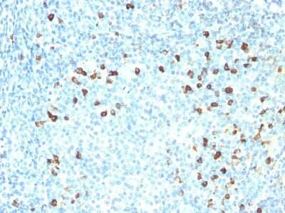 Immunohistochemistry-Paraffin: Kappa Light Chain Antibody (SPM558) - Azide and BSA Free [NBP2-34423] - Formalin-paraffin human tonsil stained with Kappa Light Chain Ab (SPM558). Note cell membrane & cytoplasmic staining.
