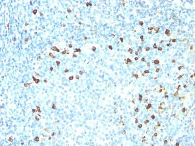 Immunohistochemistry-Paraffin: Kappa Light Chain Antibody (SPM558) [NBP2-34376] - Formalin-paraffin human tonsil stained with Kappa Light Chain Ab (SPM558). Note cell membrane & cytoplasmic staining.