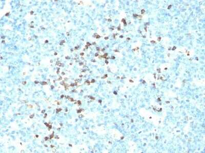 Immunohistochemistry-Paraffin: Kappa Light Chain Antibody (TB28-2) - Azide and BSA Free [NBP2-34721] - Formalin-fixed, paraffin-embedded human tonsil stained with Kappa Light Chain MAb (TB28-2). Note cell membrane & cytoplasmic staining.