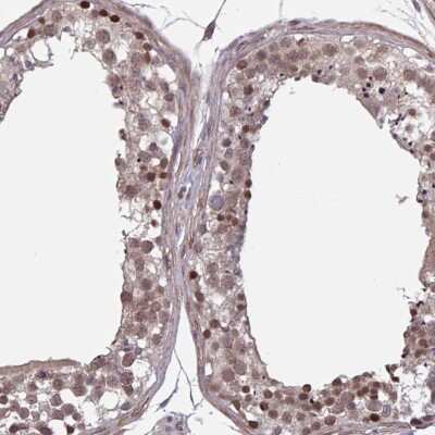 Immunohistochemistry-Paraffin: Karyopherin (importin) beta 3 Antibody [NBP2-38795] - Staining of human testis shows nuclear positivity in cells in seminiferous ducts.