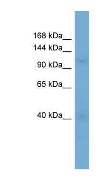 Western Blot: Karyopherin (importin) beta 3 Antibody [NBP1-79535] - Jurkat cell lysate, Antibody Titration: 0.2-1 ug/ml