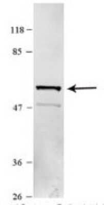 Western Blot: Karyopherin (importin) beta 3 Antibody [NBP1-79535] - Sample Type: HEK 293 (10ug) Primary Dilution: 1:1000 Secondary Antibody: conjugated goat anti-rabbit Secondary Dilution: 1:10,000 Image Submitted By: Amy Gray Brigham Young University.