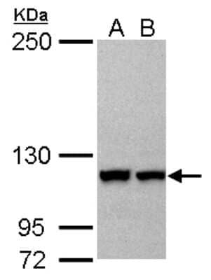 Western Blot: Karyopherin (importin) beta 3 Antibody [NBP2-17016] - Sample (30 ug of whole cell lysate) A: NT2D1 B: Hela 5% SDS PAGE gel, diluted at 1:2000.