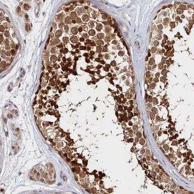 Immunohistochemistry-Paraffin: Katanin p60 Antibody [NBP1-89491] - Staining of human testis shows strong cytoplasmic positivity in cells in seminiferus ducts.