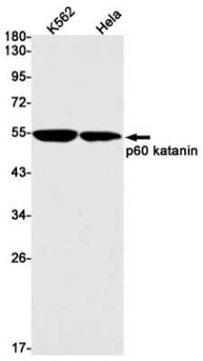 Western Blot: Katanin p60 Antibody (S05-3B9) [NBP3-15050] - Western blot detection of Katanin p60 in K562, Hela cell lysates using Katanin p60 Rabbit mAb (1:1000 diluted). Predicted band size: 56kDa. Observed band size: 56kDa.