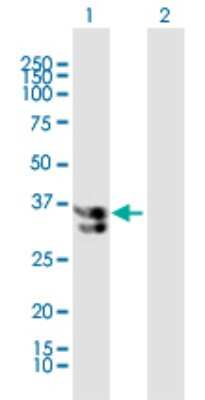 Western Blot: Katanin p60 Antibody [H00011104-B01P] - Analysis of KATNA1 expression in transfected 293T cell line by KATNA1 polyclonal antibody.  Lane 1: KATNA1 transfected lysate(34.32 KDa). Lane 2: Non-transfected lysate.