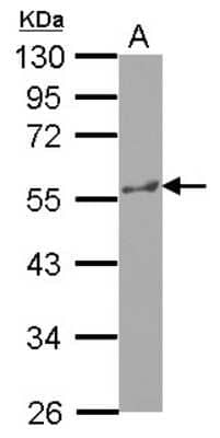 Western Blot: Katanin p60 Antibody [NBP2-17019] - Sample (30 ug of whole cell lysate) A: HepG2 10% SDS PAGE gel, diluted at 1:1000.