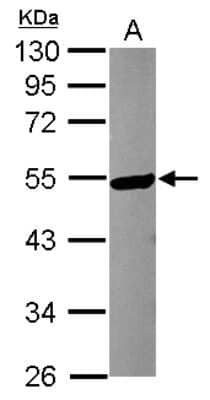 Western Blot: Katanin p60 Antibody [NBP2-17020] - Sample (30 ug of whole cell lysate) A: MCF-7 10% SDS PAGE gel, diluted at 1:3000.