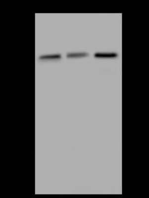 Western Blot: Katanin p60 Antibody [NBP2-97830] - Anti-Katanin p60 rabbit polyclonal antibody at 1:500 dilution. Lane A: HeLa Whole Cell Lysate. Lane B: HepG2 Whole Cell Lysate. Lane C: 293 Whole Cell Lysate. Lysates/proteins at 30 ug per lane. Secondary Goat Anti-Rabbit IgG (H+L)/HRP at 1/10000 dilution. Developed using the ECL technique. Performed under reducing conditions. Predicted band size: 56 kDa. Observed band size: 56 kDa