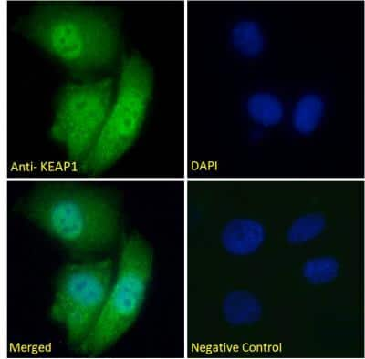 Immunocytochemistry/Immunofluorescence: Keap1 Antibody [NBP1-78793] - Analysis of paraformaldehyde fixed HeLa cells, permeabilized with 0.15% Triton. Primary incubation 1hr (5ug/ml) followed by Alexa Fluor 488 secondary antibody (2ug/ml), showing nuclear and cytoplasmic staining. The nuclear stain is DAPI (blue). Negative control: Unimmunized goat IgG (5ug/ml) followed by Alexa Fluor 488 secondary antibody (2ug/ml).