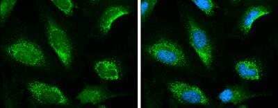 Immunocytochemistry/Immunofluorescence: Keap1 Antibody [NBP2-17036] -  HeLa cells were fixed in 4% paraformaldehyde at RT for 15 min. Green: KEAP1 protein stained by KEAP1 antibody [C1C3] diluted at 1:500. Blue: Hoechst 33342 staining.