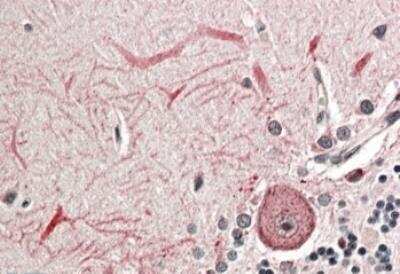 Immunohistochemistry-Paraffin: Keap1 Antibody [NBP1-78793] - Staining of paraffin embedded Human Cerebellum with antibody at 3.8 ug/mL. Steamed antigen retrieval with citrate buffer pH 6, AP-staining.