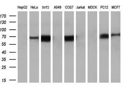 Western Blot: Keap1 Antibody (OTI1B4) - Azide and BSA Free [NBP2-71496] - Analysis of extracts (35ug) from 9 different cell lines by using anti-KEAP1 monoclonal antibody at 1:200 dilution. (HepG2: human; HeLa: human; SVT2: mouse; A549: human; COS7: monkey; Jurkat: human; MDCK: canine; PC12: rat; MCF7: human)