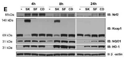 Western Blot: Keap1 Antibody (OTI1B4) [NBP2-03319] - Analysis of human BEAS2B cells.