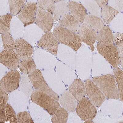 Immunohistochemistry-Paraffin: Kelch Domain Containing 7A Antibody [NBP2-30941] - Staining of human skeletal muscle shows moderate cytoplasmic positivity in myocytes.