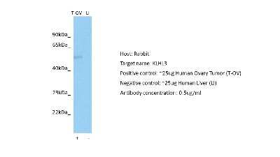 Western Blot: Kelch-Like 3 Antibody [NBP2-87675] - Host: Rabbit. Target: KLHL3. Positive control (+): Human Ovary Tumor (T-OV). Negative control (-): Human Liver (LI). Antibody concentration: 0.5ug/ml
