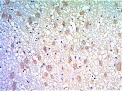 Immunohistochemistry: Kelch-Like Family Member 21 Antibody (2H4) [NBP2-37659] - Immunohistochemical analysis of paraffin-embedded human brain tissues using KLHL21 mouse mAb with DAB staining.