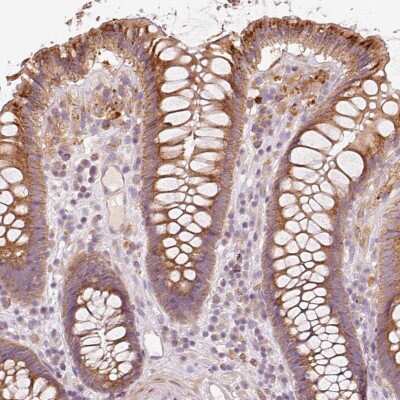 Immunohistochemistry-Paraffin: Kelch-Like Family Member 21 Antibody [NBP2-30654] - Staining of human colon shows strong cytoplasmic positivity in a granular pattern in glandular cells.