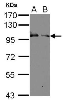 Western Blot: Kell Antibody [NBP1-33660] -  Sample (30 ug of whole cell lysate) A: K562 B: THP-1 7.5% SDS PAGE; antibody diluted at 1:10000.