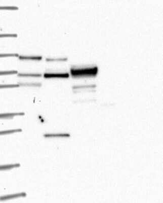 Western Blot: Kell Antibody [NBP3-17727] - Lane 1: Marker [kDa] 250, 130, 95, 72, 55, 36, 28, 17, 10;   Lane 2: RT4;   Lane 3: U-251 MG;   Lane 4: Human Plasma;   Lane 5: Liver;   Lane 6: Tonsil