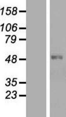 Western Blot: Keratan Sulfate Overexpression Lysate (Adult Normal) [NBL1-09191] Left-Empty vector transfected control cell lysate (HEK293 cell lysate); Right -Over-expression Lysate for Keratan Sulfate.