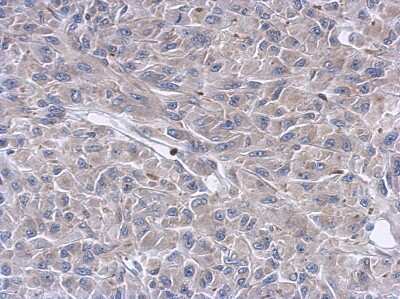 Immunohistochemistry-Paraffin: Keratin 36 Antibody [NBP2-17039] - Immunohistochemical analysis of paraffin-embedded U87 xenograft, using antibody at 1:500 dilution.