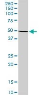 Western Blot: Keratin 36 Antibody [H00008689-B01P] - Analysis of KRT36 expression in HeLa.