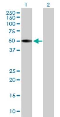 Western Blot: Keratin 36 Antibody [H00008689-B01P] - Analysis of KRT36 expression in transfected 293T cell line by KRT36 polyclonal antibody.  Lane 1: KRTHA6 transfected lysate(45.87 KDa). Lane 2: Non-transfected lysate.