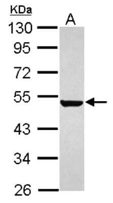 Western Blot: Keratin 36 Antibody [NBP2-17038] - Sample (30 ug of whole cell lysate) A: HeLa 10% SDS PAGE gel, diluted at 1:1000.