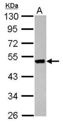 Western Blot: Keratin 36 Antibody [NBP2-17039] - Sample (30 ug of whole cell lysate) A: HeLa 10% SDS PAGE gel, diluted at 1:1000.