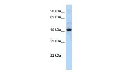 Western Blot: Keratin 36 Antibody [NBP2-82263] - Host: Rabbit. Target Name: KRT36. Sample Type: NCI-H226 Whole cell lysates. Antibody Dilution: 1.0ug/mlKRT36 is supported by BioGPS gene expression data to be expressed in NCIH226