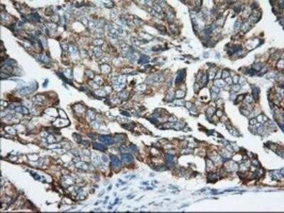 Immunohistochemistry: Ketohexokinase Antibody (OTI1D8) - Azide and BSA Free [NBP2-71069] - ketohexokinase Antibody (1D8) [NBP2-02639