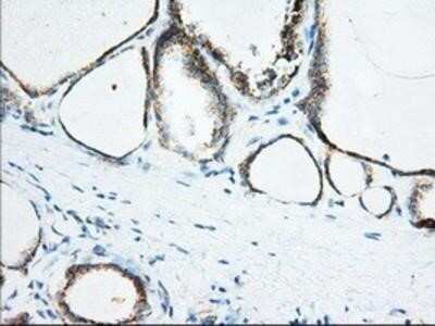 Immunohistochemistry: Ketohexokinase Antibody (OTI1D8) - Azide and BSA Free [NBP2-71069] - ketohexokinase Antibody (1D8) [NBP2-02639