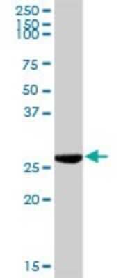 Western Blot: Ketohexokinase Antibody [H00003795-D01P] - Analysis of KHK expression in human spleen.