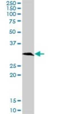 Western Blot: Ketohexokinase Antibody [H00003795-D01P] - Analysis of KHK expression in mouse kidney.
