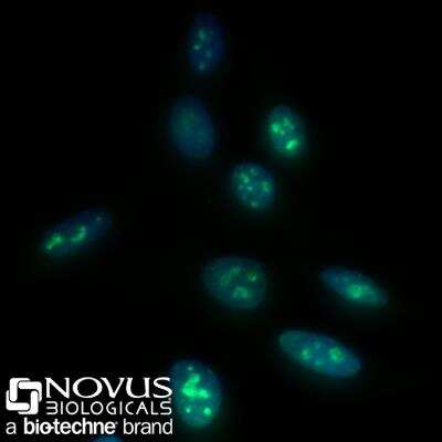 Immunocytochemistry/Immunofluorescence: Ki-67/MKI67 Antibody (8D5) [Alexa Fluor 488] [NBP2-22112AF488] - HeLa cells were fixed for 10 minutes using 10% formalin and then permeabilized for 5 minutes using 1X PBS + 0.5% Triton-X100.  The cells were incubated with anti-Ki-67 (8D5) conjugated to Alexa Fluor 488 [NBP2-22112AF488] at 10ug/ml for 1 hour at room temperature.  Nuclei were counterstained with DAPI (Blue).  Cells were imaged using a 40X objective.