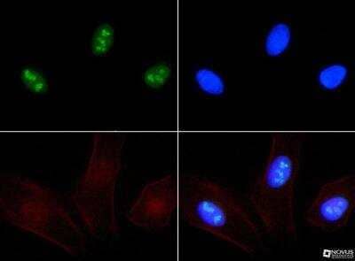 Immunocytochemistry/Immunofluorescence: Ki-67/MKI67 Antibody [NB500-170DL594] - Ki67 antibody was tested at 1:25 in HeLa cells with FITC (green). Nuclei and actin were counterstained with Dapi (blue) and Phalloidin (red).