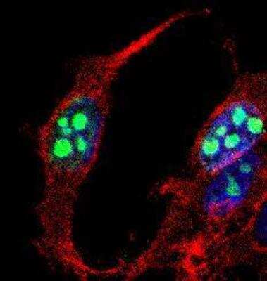 Immunocytochemistry/Immunofluorescence: Ki-67/MKI67 Antibody [NB500-170DL594] - Confocal immunofluorescent analysis of MCF7 cells using Ki67 antibody (NB500-170, 1:5). An Alexa Fluor 488-conjugated Goat to rabbit IgG was used as secondary antibody (green). Actin filaments were labeled with Alexa Fluor 568 phalloidin (red). DAPI was used to stain the cell nuclei (blue).