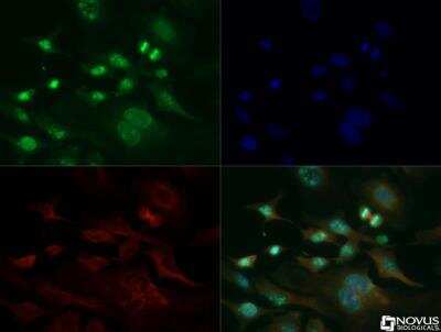 Immunocytochemistry/Immunofluorescence: Ki-67/MKI67 Antibody [NB500-170DL594] - Nuclei and alpha-tubulin were counterstained with DAPI (blue) and Dylight 550 (red). Image objective 40x.