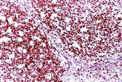 Immunohistochemistry-Paraffin: Ki-67/MKI67 Antibody [NB500-170DL594] - Human tonsil.