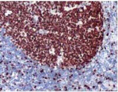 Immunohistochemistry-Paraffin: Ki-67/MKI67 Antibody [NB600-1209] - Human Tonsil stained with anti-Ki-67 antibody.