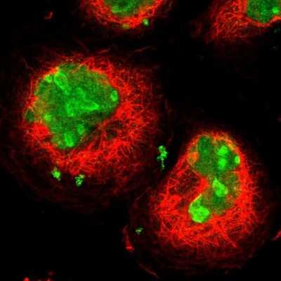 <b>Orthogonal Strategies Validation. </b>Immunocytochemistry/Immunofluorescence: Ki67/MKI67 Antibody [NBP2-54656] - Staining of human cell line A-431 shows localization to nucleus & nucleoli. Antibody staining is shown in green.