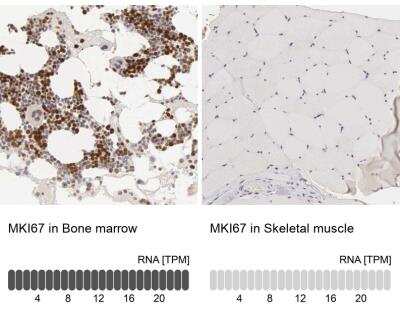 Immunohistochemistry-Paraffin: Ki67/MKI67 Antibody [NBP2-54656] - Analysis in human bone marrow and skeletal muscle tissues. Corresponding MKI67 RNA-seq data are presented for the same tissues.